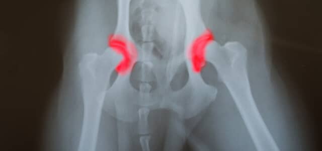 Röntgenbild von Hüftdysplasie beim Hund